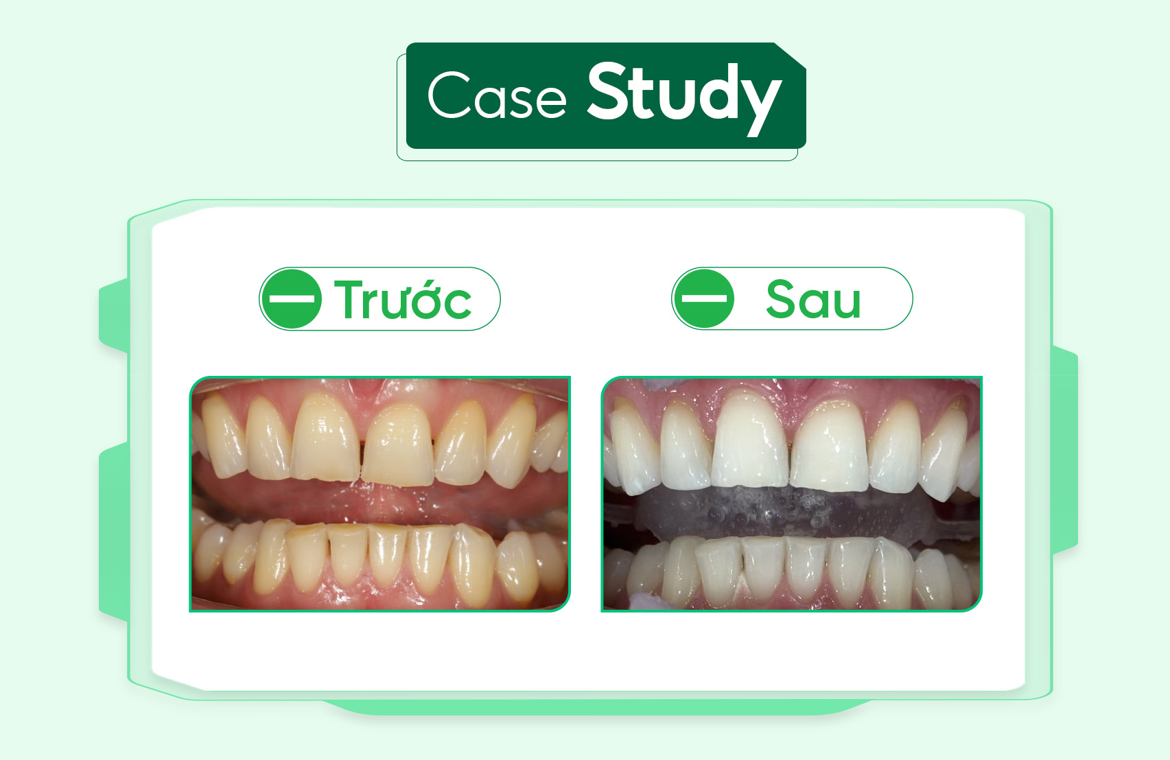 Case-tay-trang ( 2 )