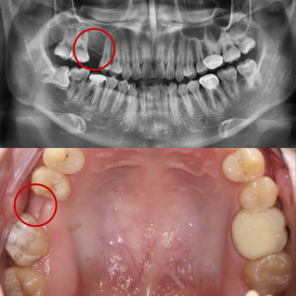 Trước điều trị