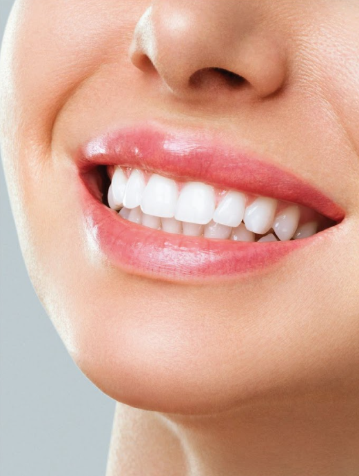Aesthetic Porcelain Crowns