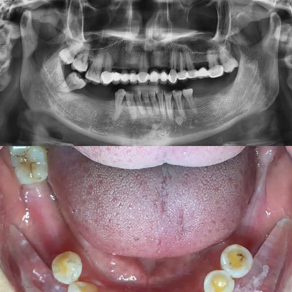 Trước điều trị