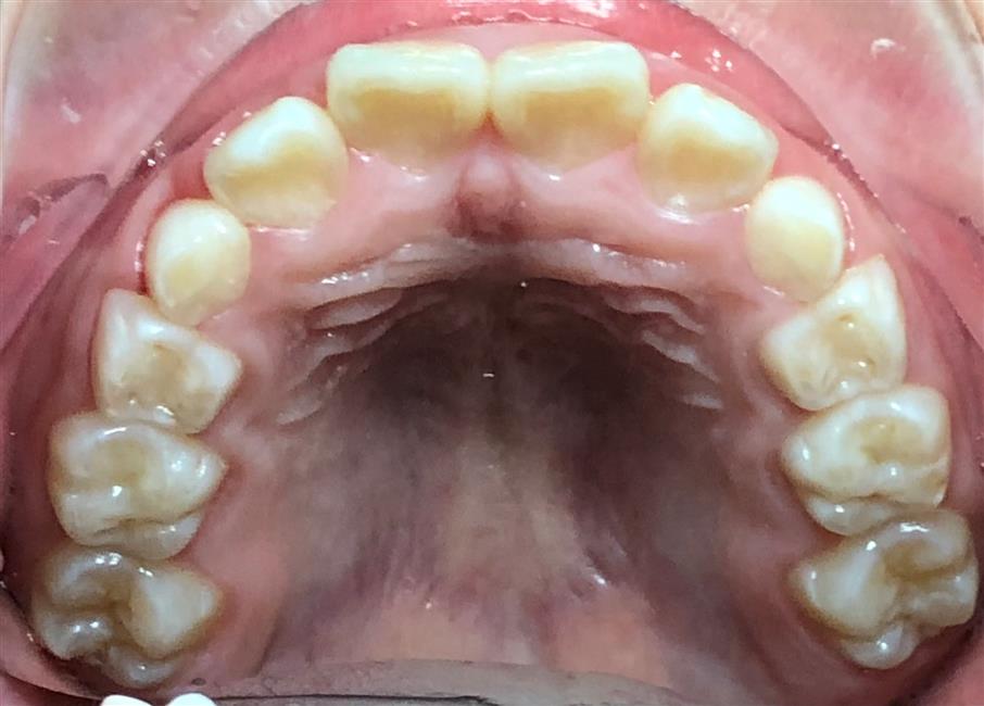 Trước điều trị