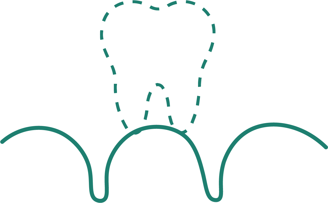 Multiple Tooth Loss