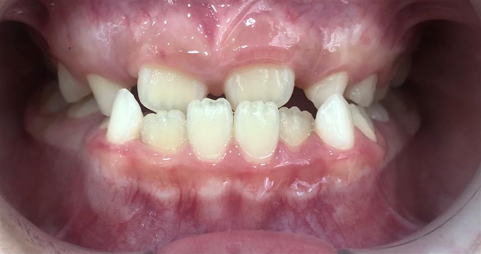 Trước điều trị