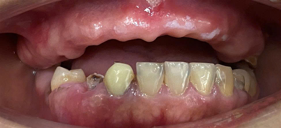 Trước điều trị