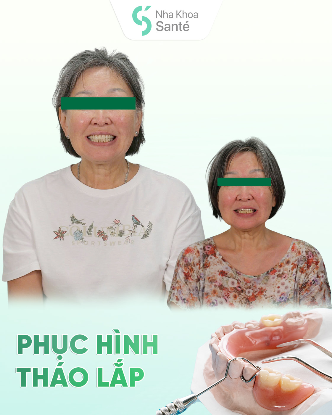 Removable Dentures