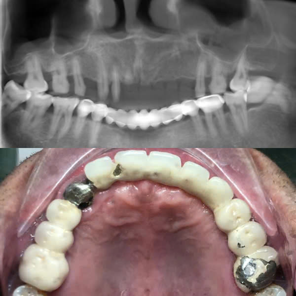 Trước điều trị