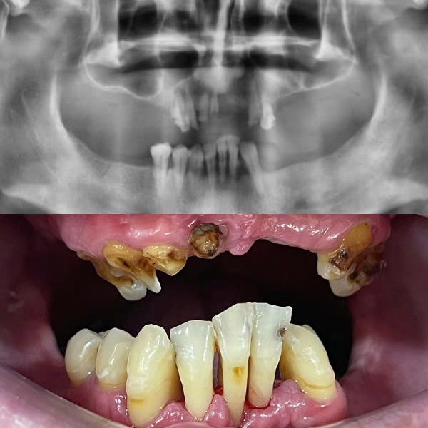 Trước điều trị