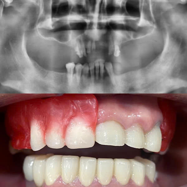 Trước điều trị