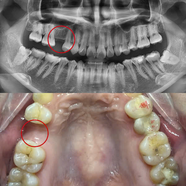 Trước điều trị