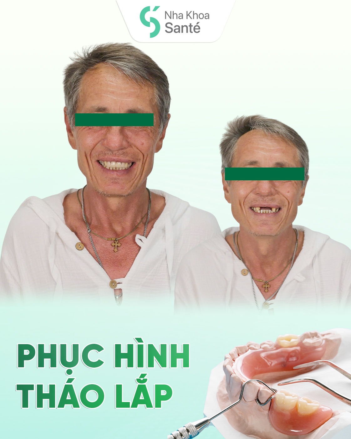Neodent Implant Placement & Cercon Porcelain Restoration