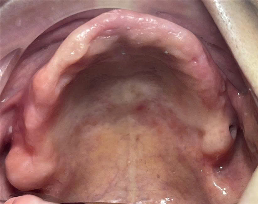 Trước điều trị
