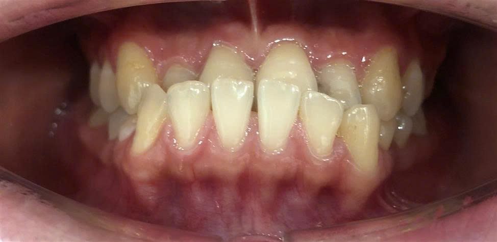 Trước điều trị