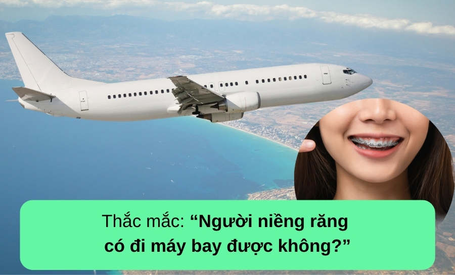 Niềng Răng Có Đi Máy Bay Được Không? Chuyên Gia Giải Đáp