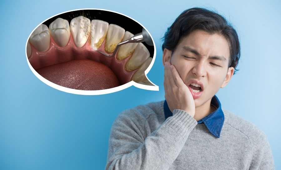 Có Nên Lấy Cao Răng Không? Quy Trình Và Chi Phí