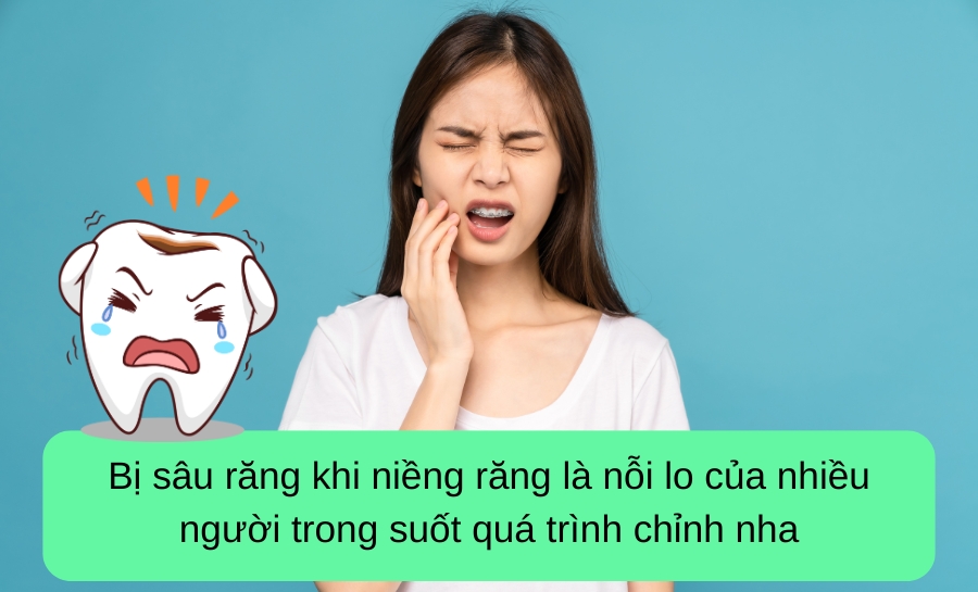 Bị Sâu Răng Khi Niềng Răng: Nguyên Nhân Và Cách Xử Lý Hiệu Quả