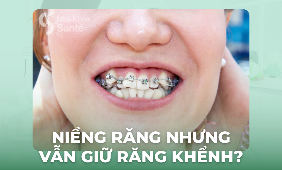 Niềng Răng Giữ Lại Răng Khểnh Có Được Không? Giải Đáp Chi Tiết Từ Bác Sĩ