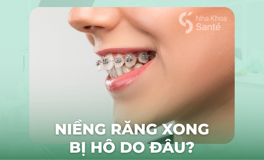 Niềng Răng Xong Bị Hô: Nguyên Nhân & Cách Xử Lý Nhanh Chóng