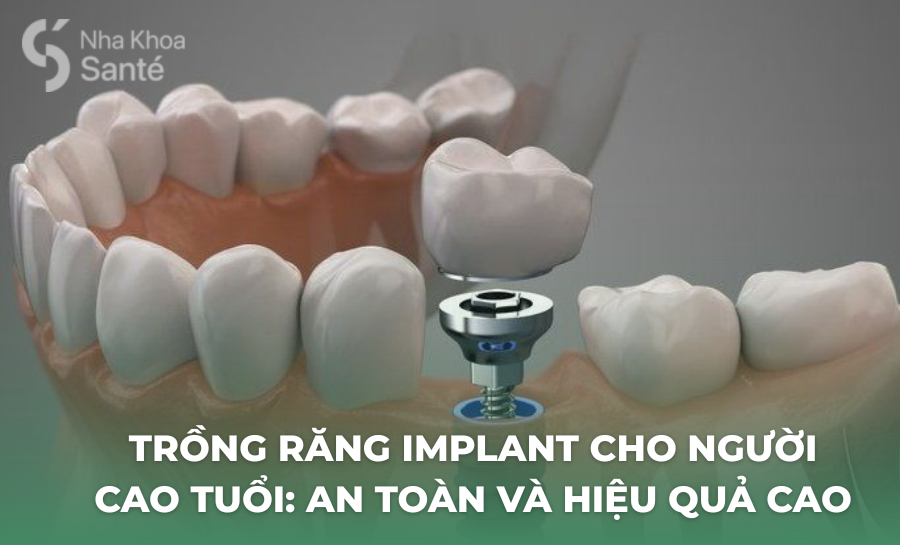 Trồng Răng Implant Cho Người Cao Tuổi: An Toàn Và Hiệu Quả Cao