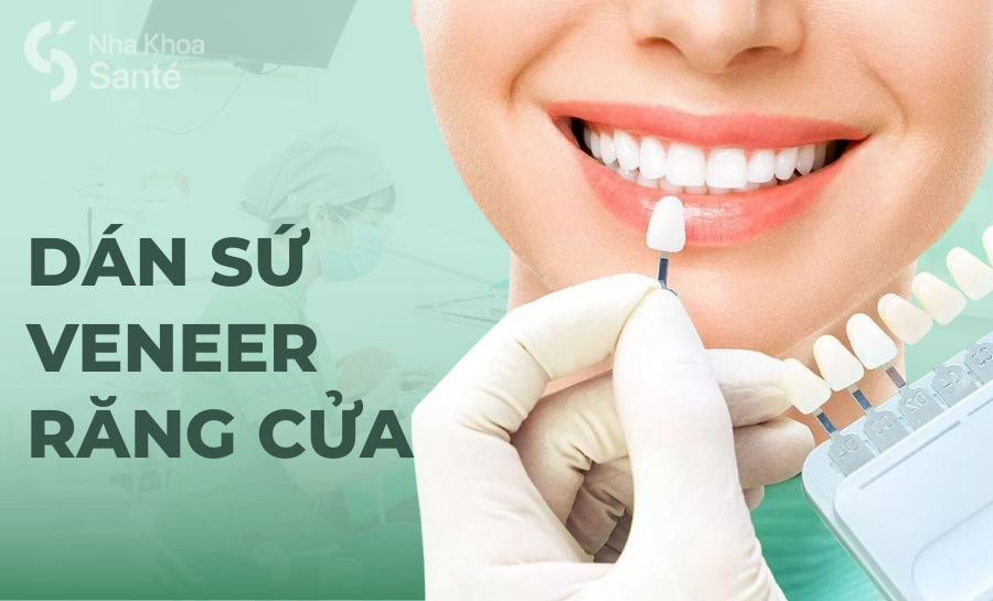 Dán Sứ Veneer Răng Cửa: Phương Pháp Thẩm Mỹ Hiệu Quả, An Toàn
