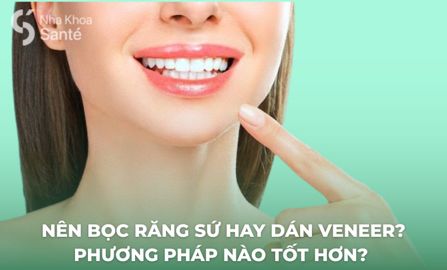 Nên Bọc Răng Sứ Hay Dán Veneer? Phương Pháp Nào Tốt Hơn?