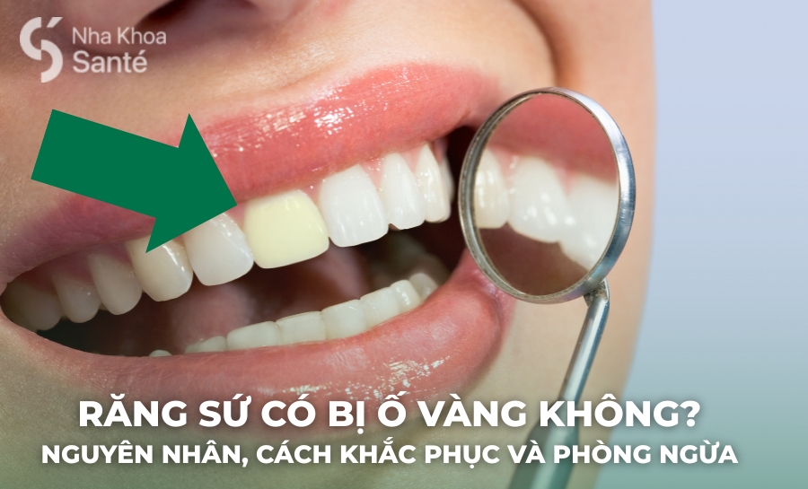 Răng Sứ Có Bị Ố Vàng Không? Nguyên Nhân, Cách Khắc Phục Và Phòng Ngừa