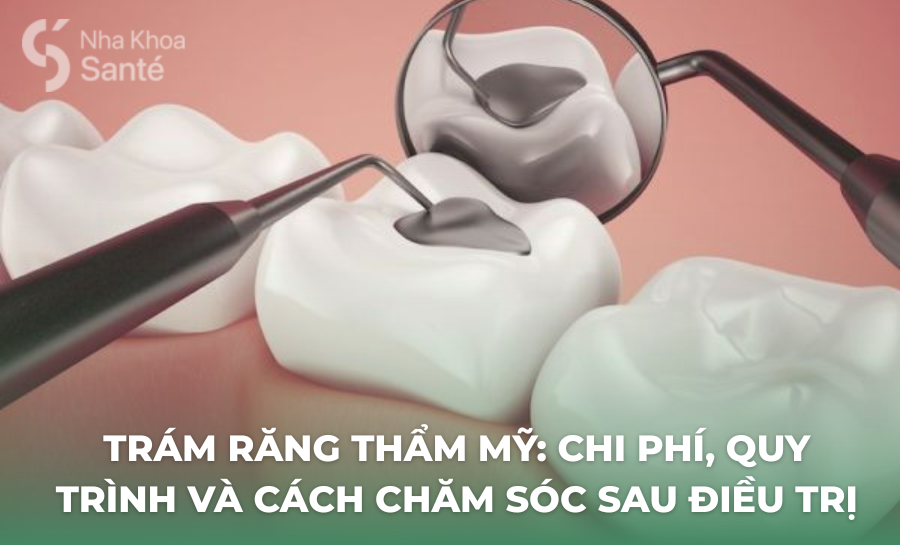Trám Răng Thẩm Mỹ Là Gì - Chi Phí, Quy Trình Và Cách Chăm Sóc Sau Điều Trị